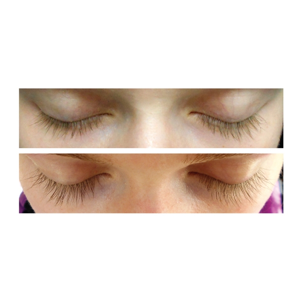 Xlash Eyelash Serum (Picture 2 of 2)